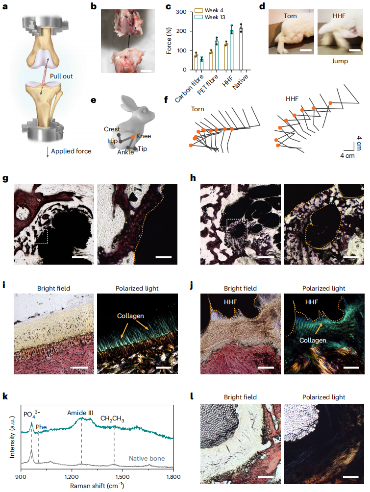 彭慧胜教授，最新Nature Nanotechnology！