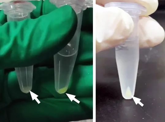 用于透射电镜观察的生物样本该怎样预处理？