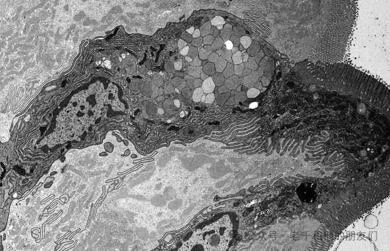 穿越时光：生物样品 TEM 制备方法的发展溯源，从化学固定到免疫金标记的技术演进