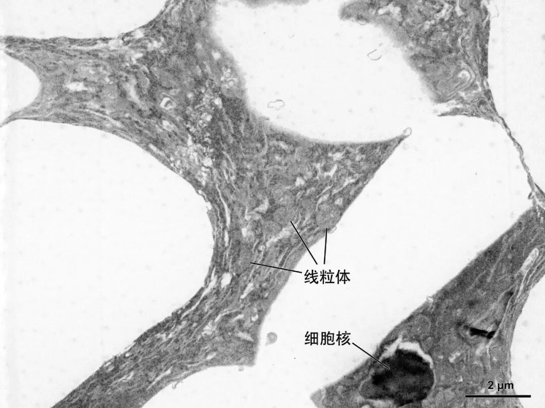 用于透射电镜观察的生物样本该怎样预处理？