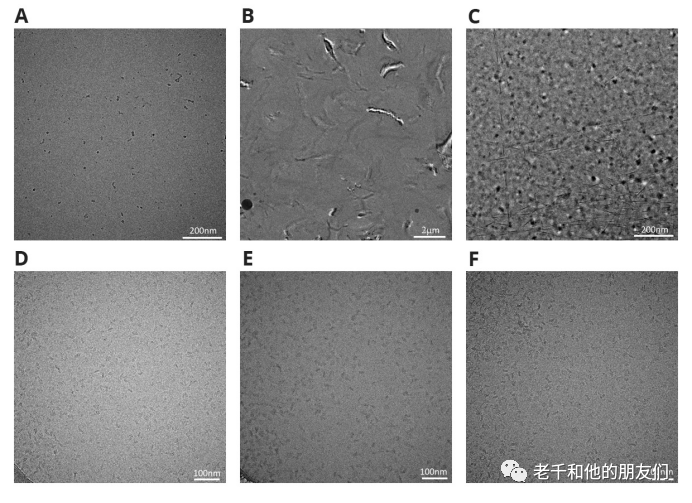 冷冻电镜单颗粒分析（SPA）技术指南：从样品制备到三维重构，解锁生物大分子高分辨率结构