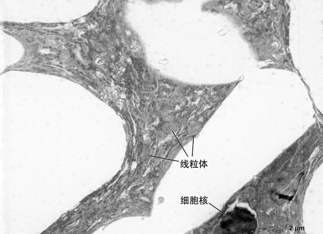 生物透射电镜（脂质体、细胞、真菌）制样要求及负染技术的详细介绍