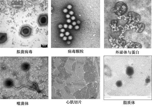 生物透射电镜（脂质体、细胞、真菌）制样要求及负染技术的详细介绍