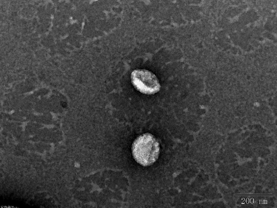 生物透射电镜（脂质体、细胞、真菌）制样要求及负染技术的详细介绍