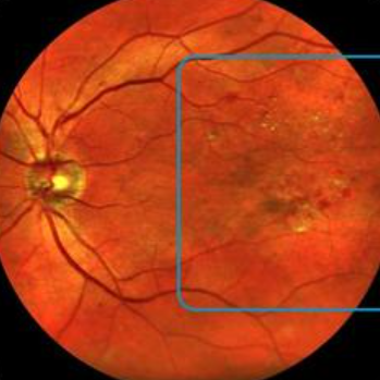 激光共聚焦显微镜（二）功能及应用领域