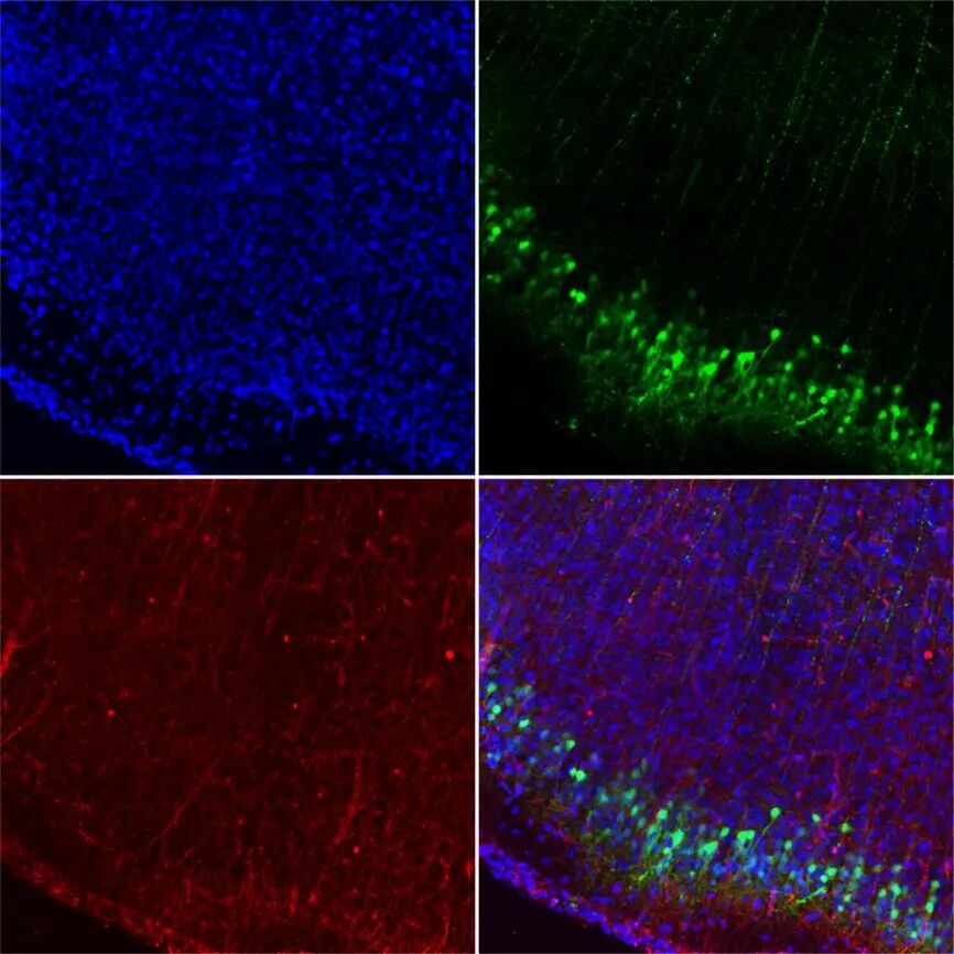 激光共聚焦显微镜（二）功能及应用领域