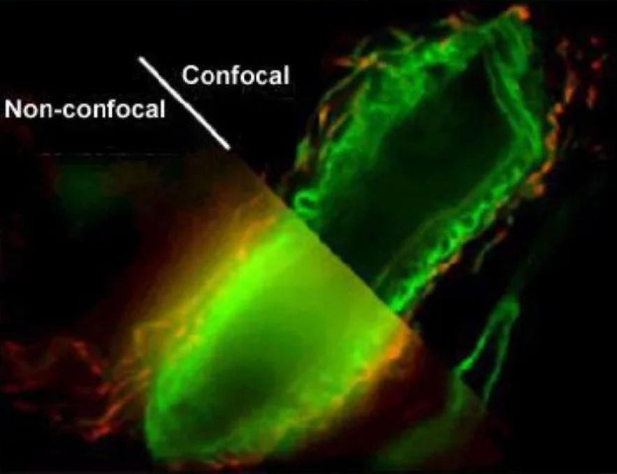 激光共聚焦显微镜（一）结构及成像原理